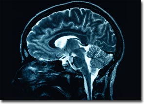 Escaner cerebral