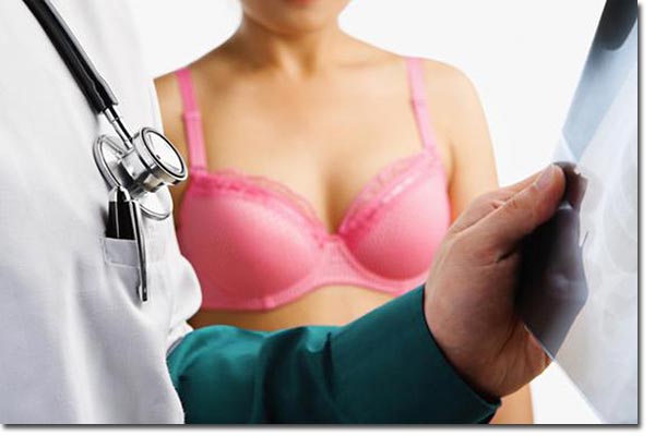 mamografias, diagnostico y tratamiento