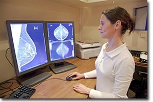 mamografias, estudio y diagnostico