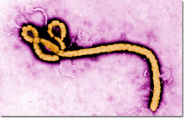 virus del ébola