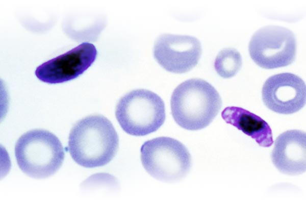 Plasmodium Falciparum en sangre. Fotos: Cedidas por Santiago Mas-Coma